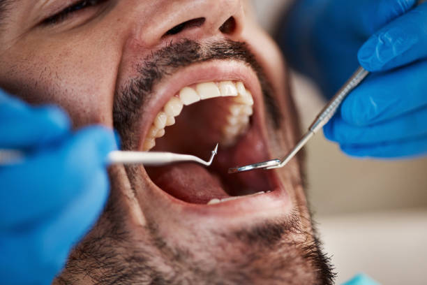 Best Wisdom Tooth Removal  in Kamiah, ID
